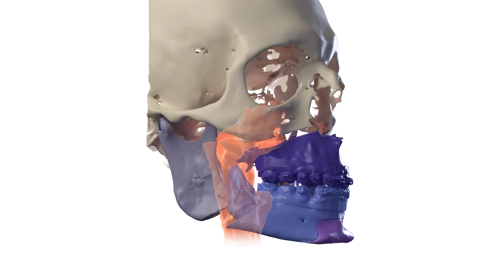 Imagen 3D: Se planifica antes