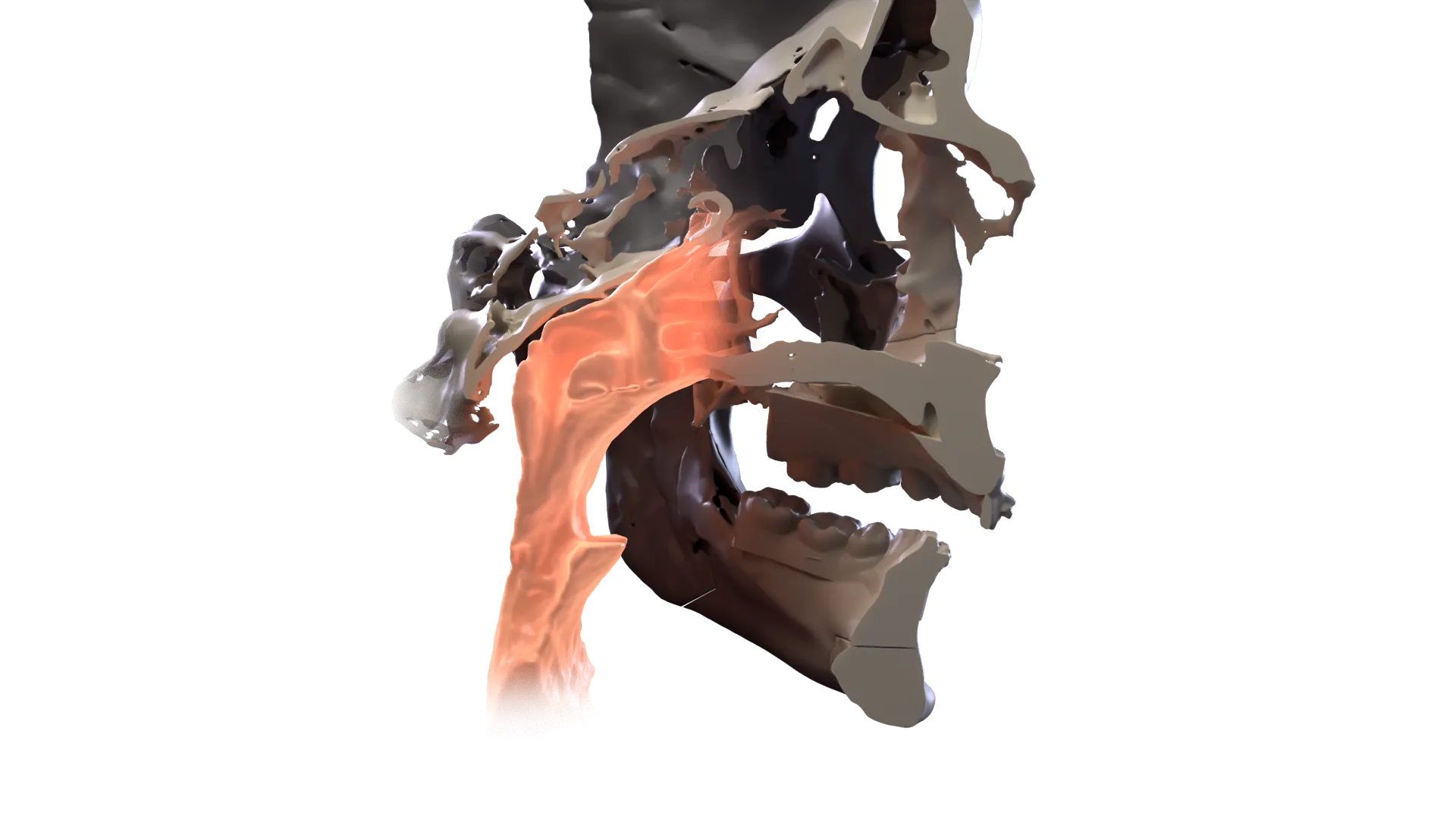 Imagen 3D: Mordida profunda, rostro corto