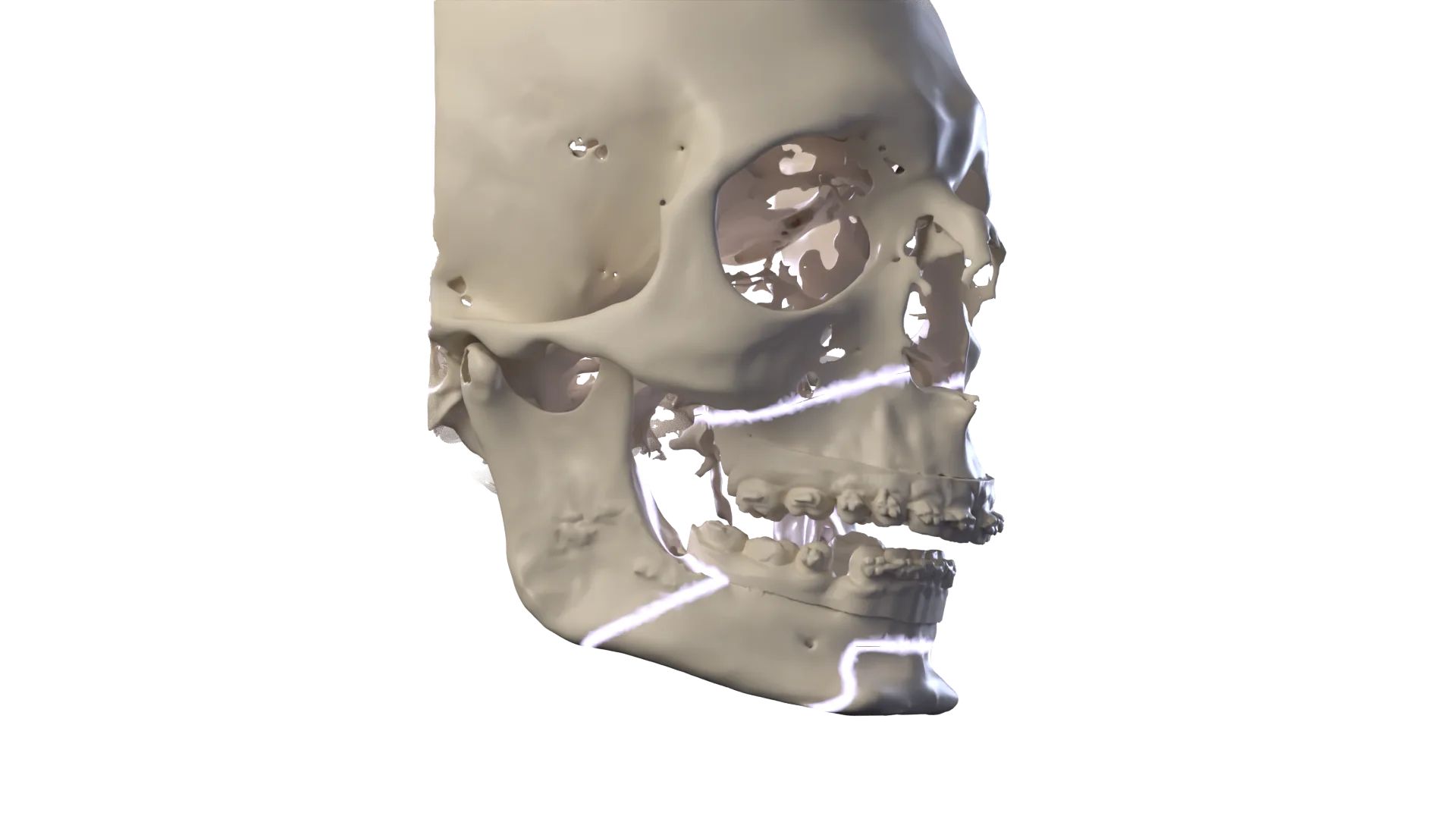 Imagen 3D: Capítulo 2 · Tu caso