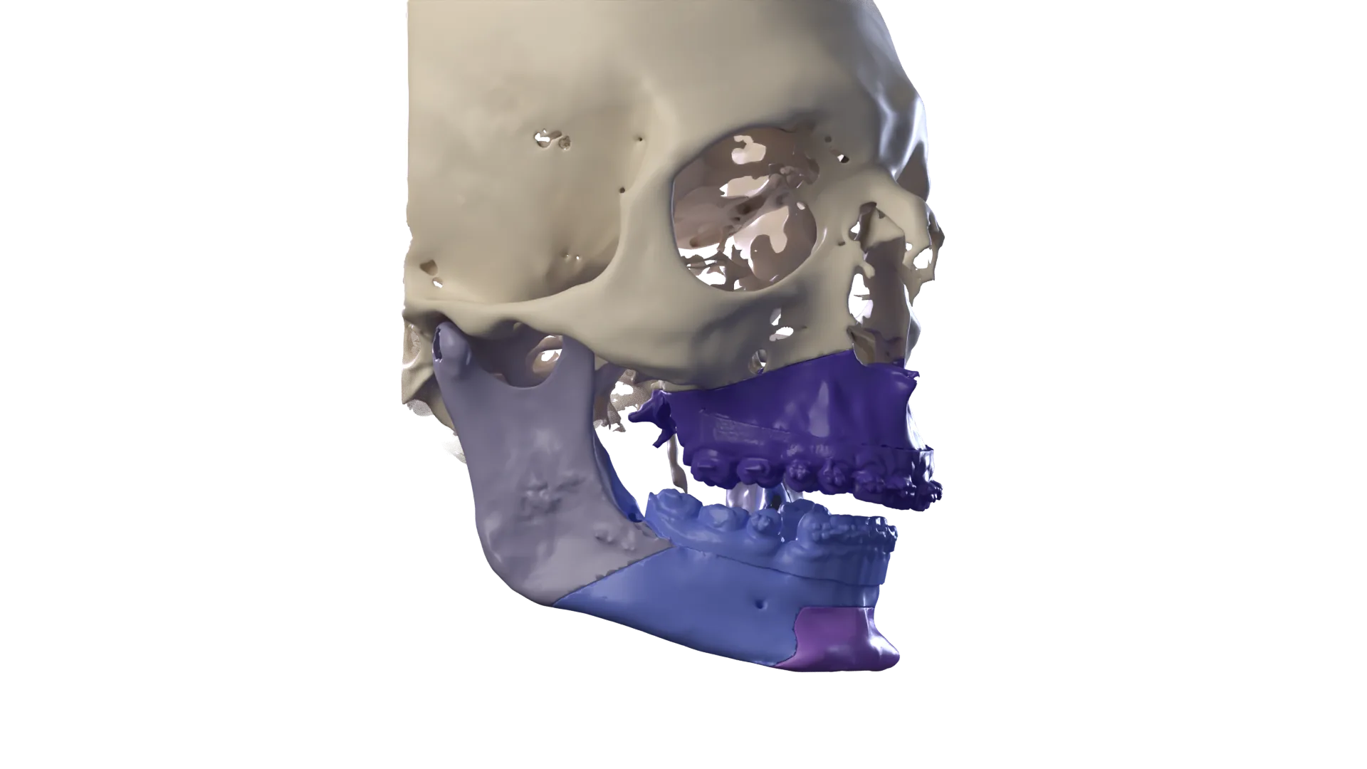 Imagen 3D: Lo que vas a encontrar